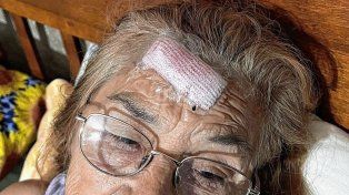 La mujer de 71 años, sufrió diferentes heridas