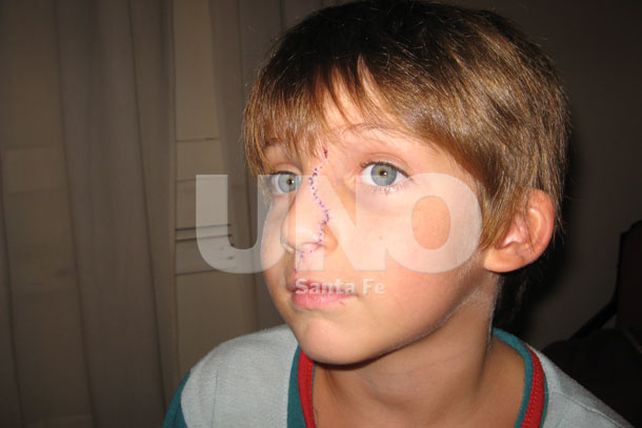 En el Alassia se realiza una cirugía cada siete días por mordeduras de perros