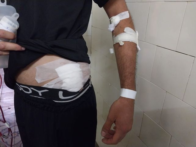 Robo de motos con extrema violencia en Santa Fe: hubo dos casos graves en pocas horas