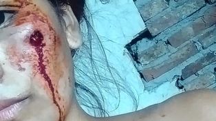 La Policía reprimió una pelea e hirió a una joven que llegaba de trabajar&nbsp;