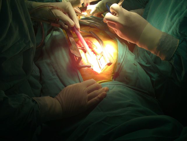 La cardiología intervencionista depende especialmente de los insumos que los especialistas tienen a disposición, los cuales son en su mayoría importados.