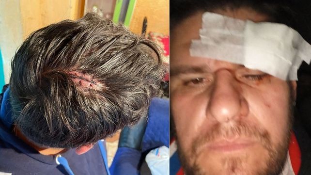 Vivió un calvario ante Unión: Por milímetros no perdí el ojo