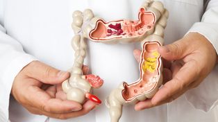 Muerte de James Van Der Beek: una enfermedad frecuente y la prueba que puede salvar vidas