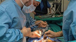 Renacer. Un equipo de médicos en el quirófano durante un trasplante, que amplía la posibilidad de vida.