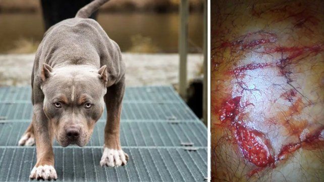 La herida que el perro le provocó al agente de policía La herida que el perro le provocó al agente de policía