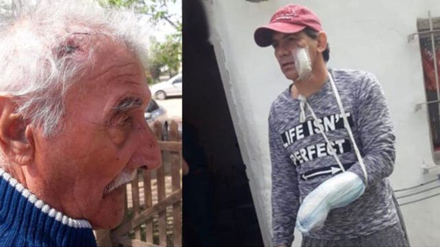 Asalto violento: delincuentes hirieron a padre e hijo