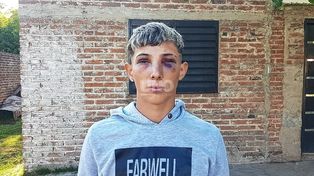 Alejandro fue agredido en un boliche de la Ruta Nacional 168.