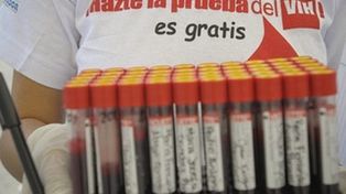 Aparece en Cuba una variante muy agresiva del virus del sida