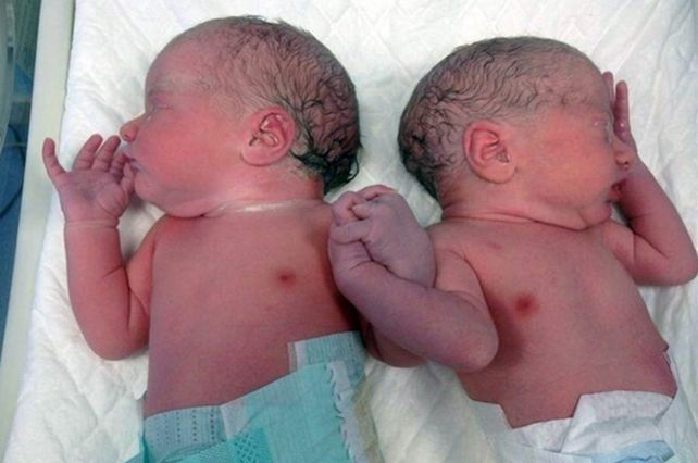 Conmovedor: dos gemelas nacieron tomadas de la mano