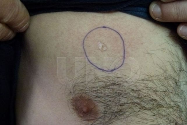 “El chaleco balístico me salvó la vida, y ésta es la tercera vez”