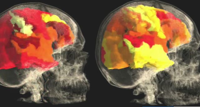 &iquest;Qu&eacute; sucede en el cerebro de las mujeres durante y despu&eacute;s de un orgasmo?