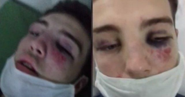 Adriel, que está internado por los golpes, sufrió varias patadas en la cabeza de parte de un joven que le robó el celular.