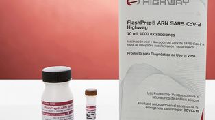 El kit de producción nacional que permite hacer la prueba PCR más rápida y económica