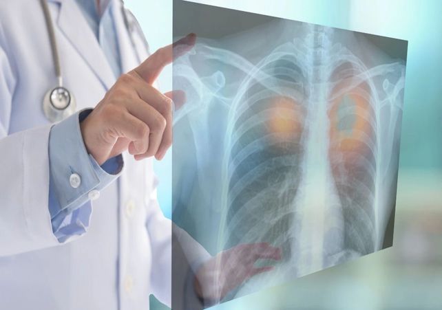 La mayor disponibilidad de tecnología para la detección también podría haber elevado las cifras mundiales.
