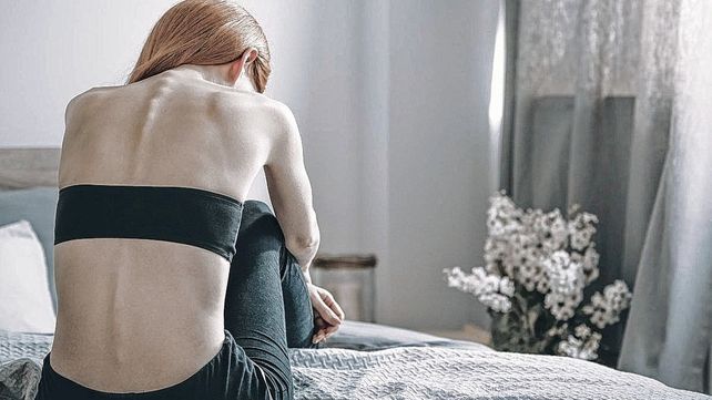 Trastornos alimentarios afectan sobre todo a adolescentes.