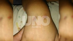 Brutal: el relato de la mamá del nene de 3 años picaneado por delincuentes