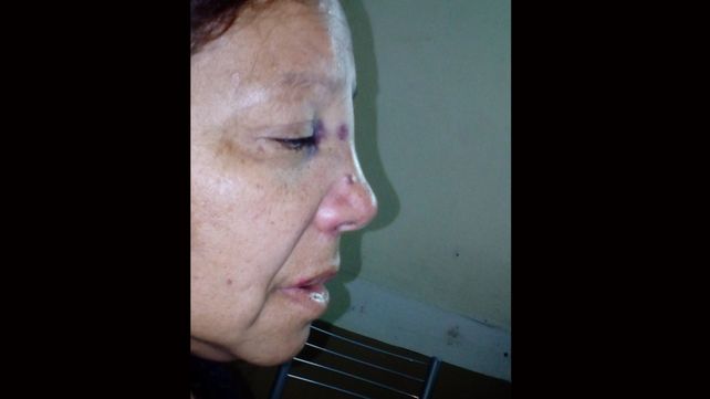 Una discusión entre vecinos terminó con una mujer salvajemente golpeada