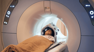 Los resonadores magnéticos son equipos que sirven para diagnosticar distintas patologías&nbsp;