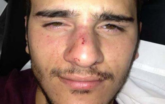 Víctima. Robledo denunció a dos alumnos del Colegio Marín por la agresión.