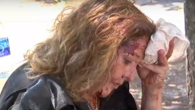 Sandra se toma la cabeza con una toalla para detener la sangre. La atacaron a culatazos para robarle la moto.