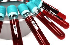 Reportan 1.870 contagios de coronavirus Covid-19 en Argentina, un 16% menos que la semana pasada. Hubo 12 muertes&nbsp;