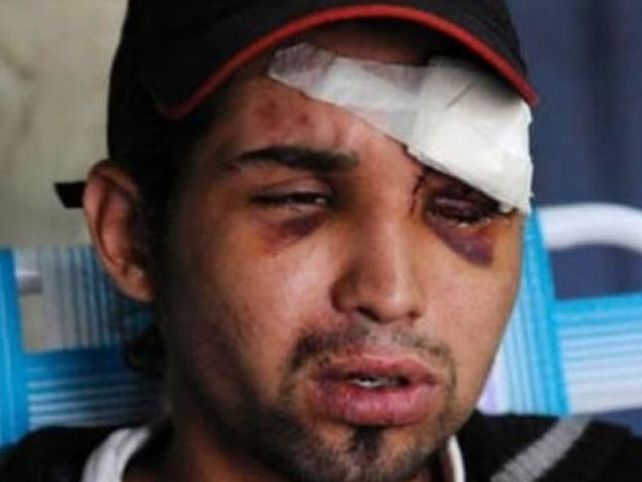 Rosario: Jóvenes were Confundidos estafa Ladrones y Una turba de vecinos los lincho