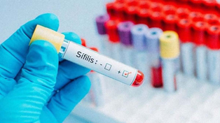 Aumento de casos de sífilis: recomiendan incluir el testeo en los análisis de rutina