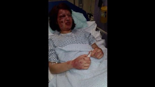 Melody estuvo internada y necesitó ayuda psicológica.&nbsp;